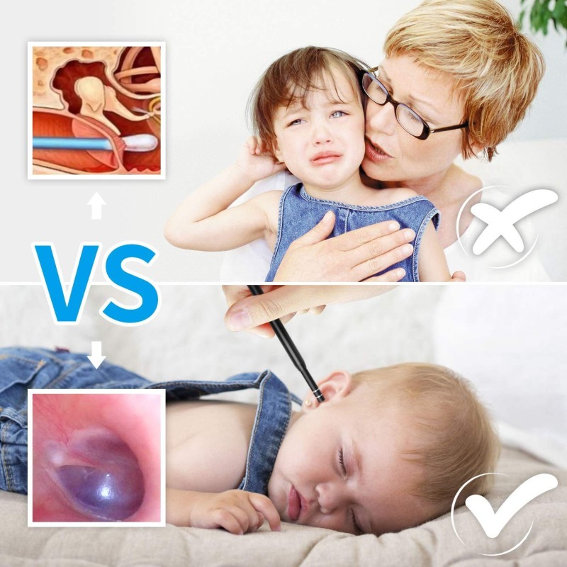 Magideal ZORBES� 1.5m Ear Otoscope USB Microscope Borescope Inspection Camera with 6LED 5.5mm